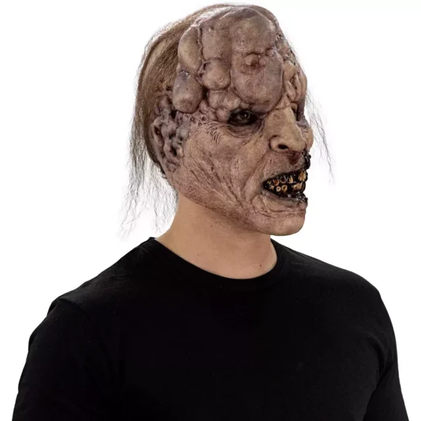 30066 2 Tumoral Deceased