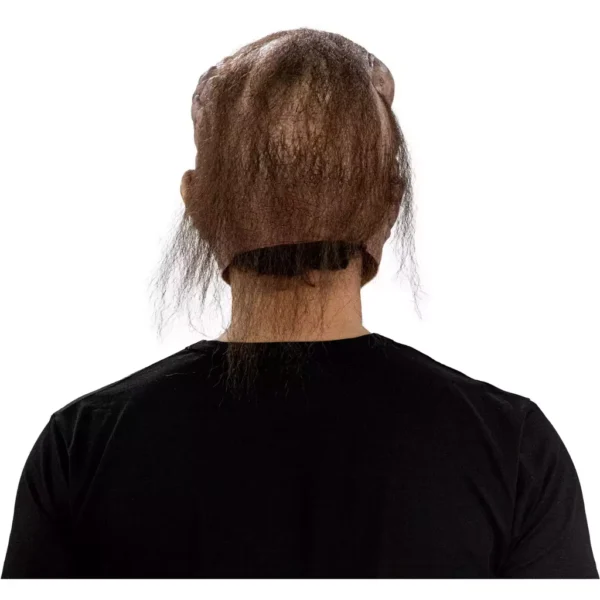 30066 4 Tumoral Deceased