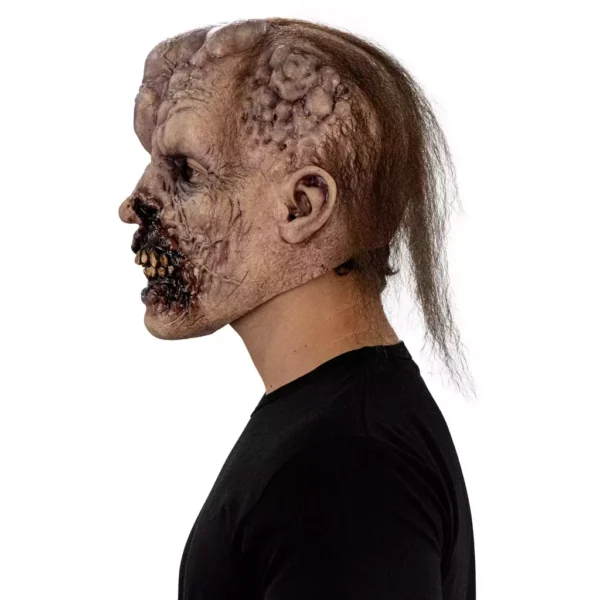 30066 5 Tumoral Deceased