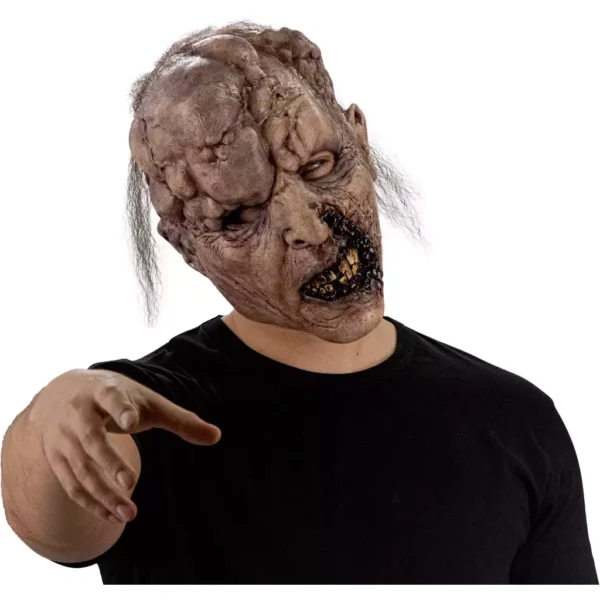 30066 7 Tumoral Deceased