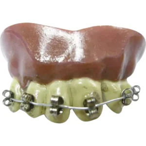 Dientes - Braquets