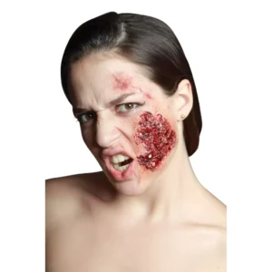 25145 Infected Itchy