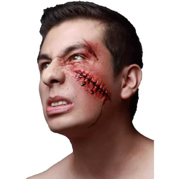 25179 1 Fail Stitches