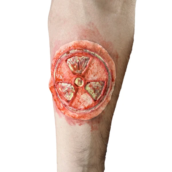 Radioactive Wound