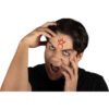Witch scar